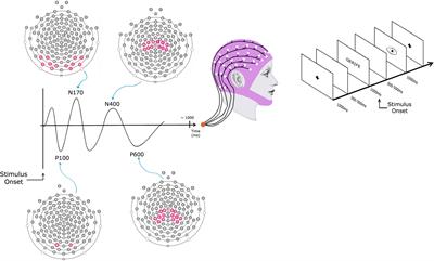 Event-related potential and lexical decision task in dyslexic adults: Lexical and lateralization effects